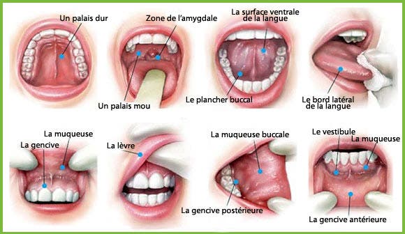 5-types-courants-de-cancer-et-leurs-symptômes-que-vous-devez-connaitre4