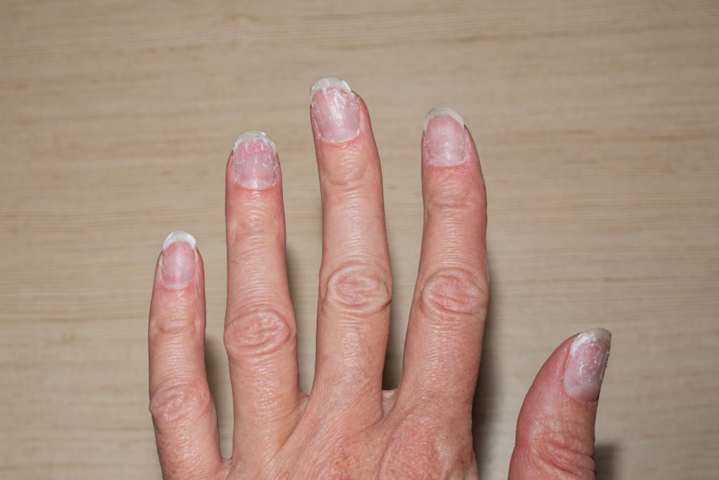 Femme hydratant ses mains