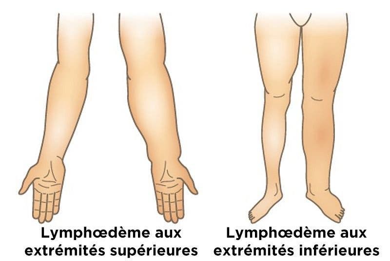 Le corps prévient avant l’arrivée de la maladie