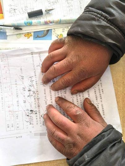 Un enfant de 8 ans arrive à l'école avec les cheveux gelés