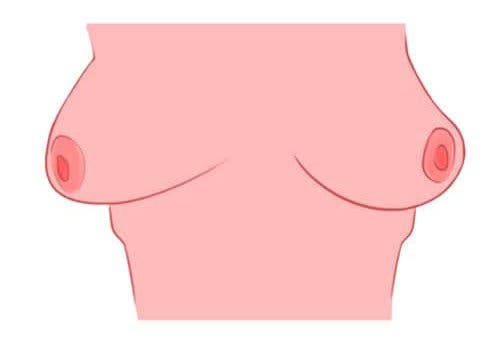 Voici ce que révèle la forme de vos seins sur votre personnalité