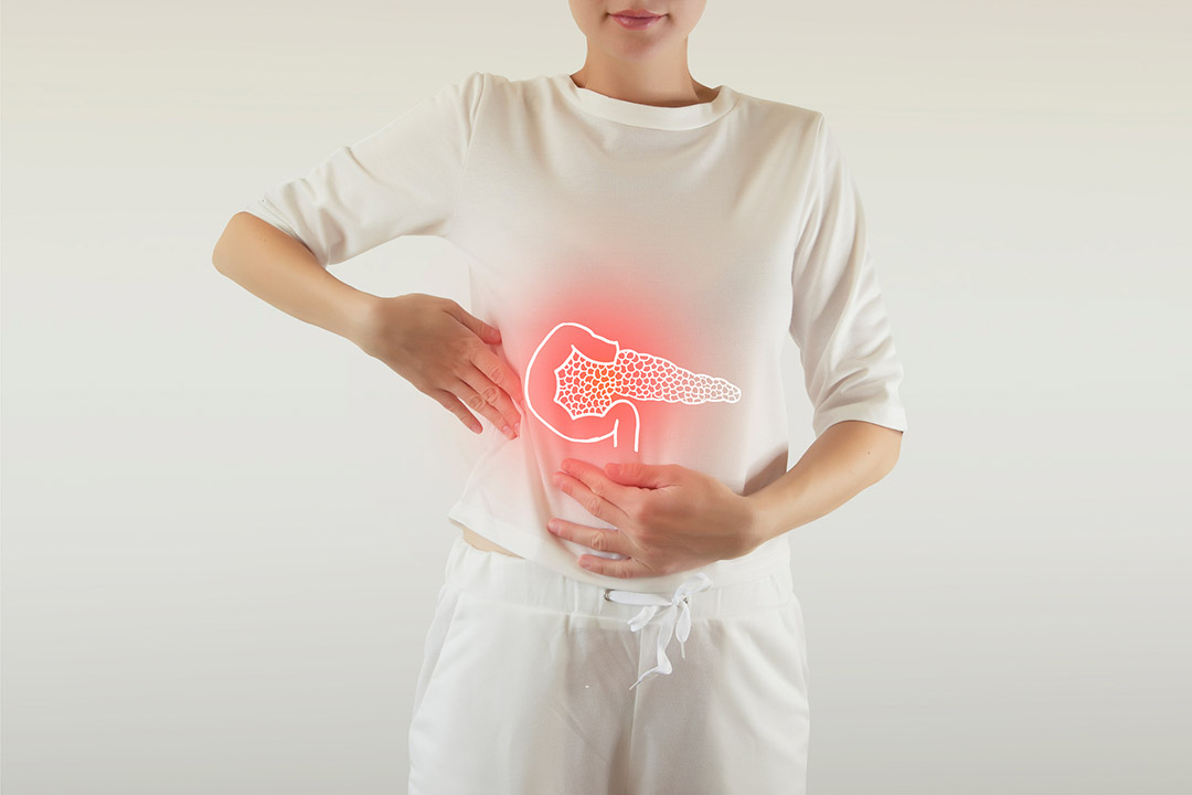 Schéma illustrant l'anatomie du pancréas et la localisation des douleurs