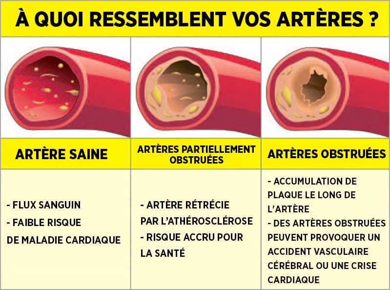 ces-3-regles-vous-aideront-a-desengorger-vos-arteres-naturellement4