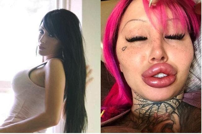 Elle dépense 88 000 euros en chirurgie et révèle les photos de sa transformation