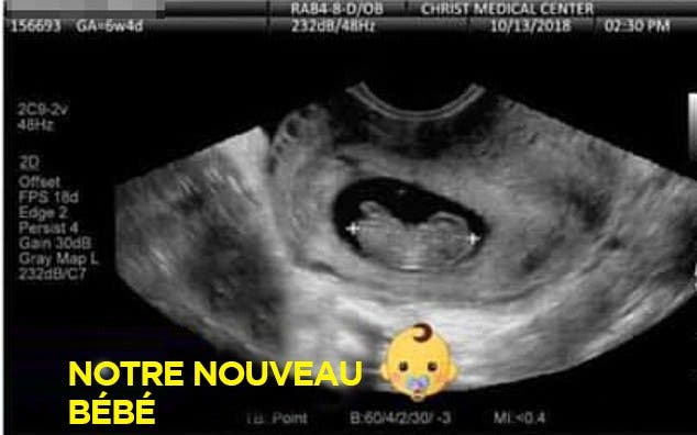 Notre nouveau bébé