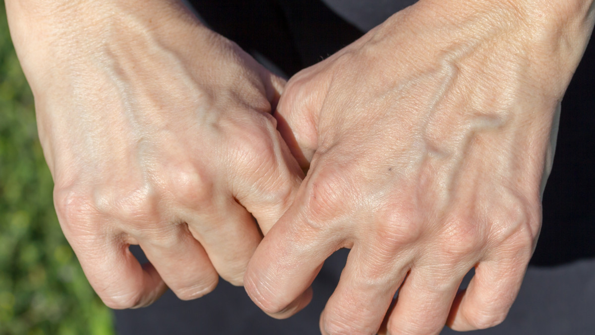 Femme prenant soin de ses mains et regardant ses veines