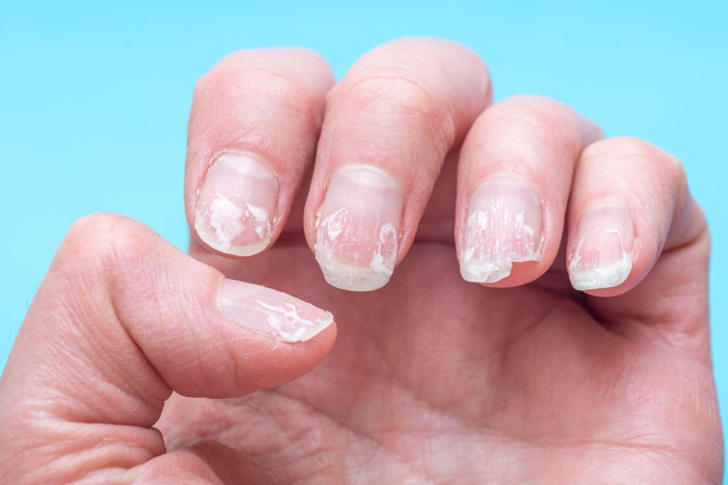 Aliments bons pour les ongles