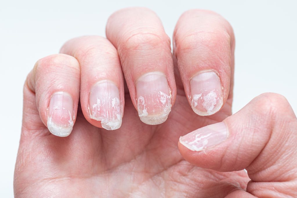 Ongles sains et soignés