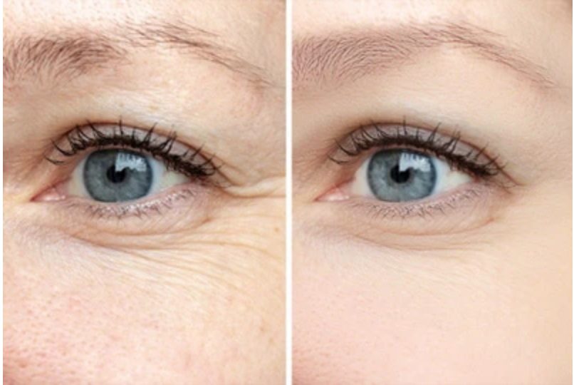 Application d'un soin visage naturel sur la peau