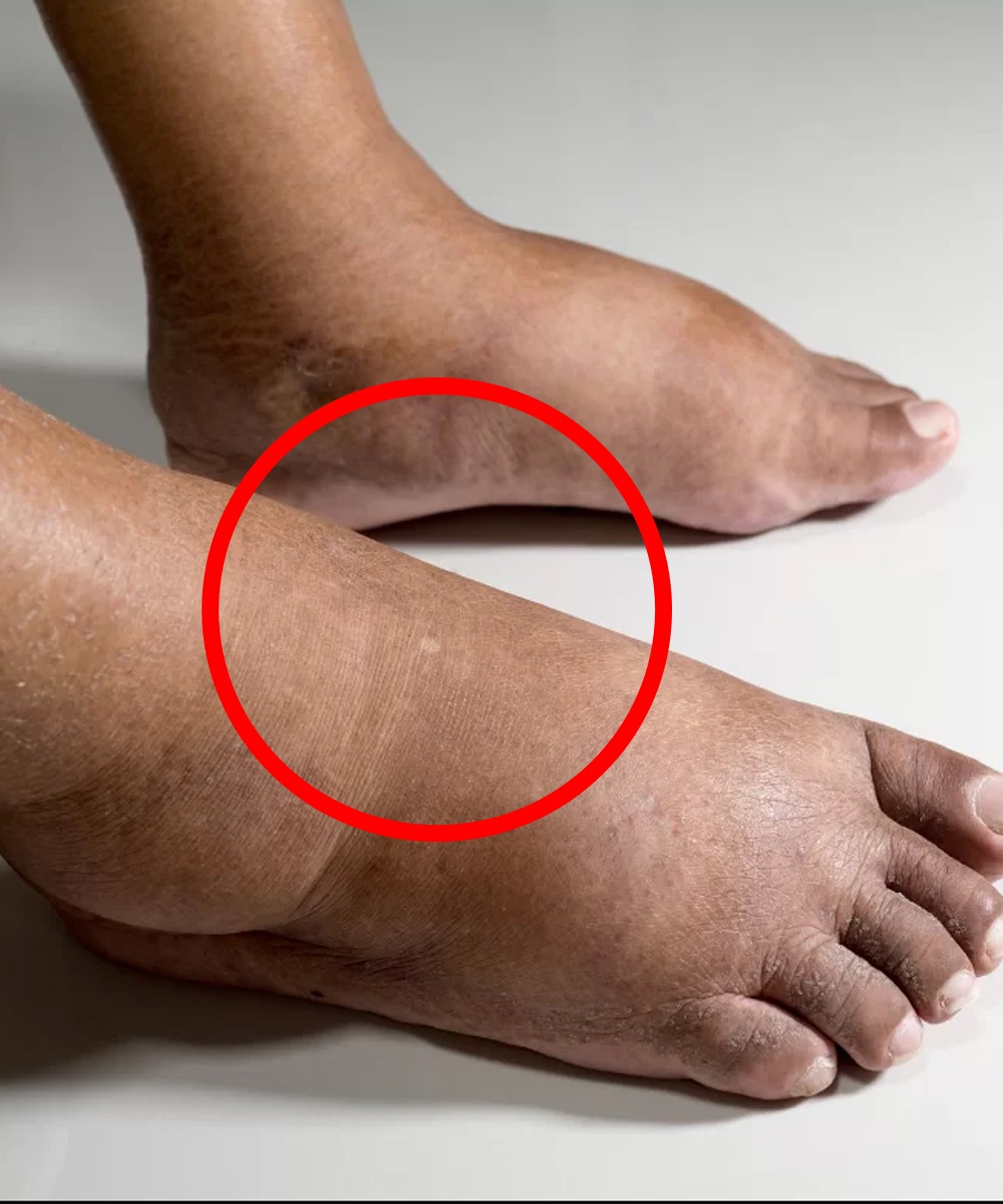 Femme massant ses pieds après une longue journée
